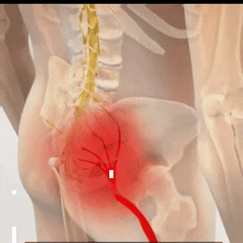 FlexiBack™ – El único cinturón cómodo y discreto que te permite volver a disfrutar de horas de pie sin dolor lumbar (Hoy GRATIS Almohada Ortopédica valorada en 29 euros).